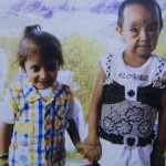 benjamin-button-cocuklar-benjamin-button-hindistan-hastalik-1537244