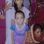 benjamin-button-cocuklar-benjamin-button-hindistan-hastalik-1537249