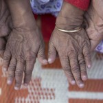 benjamin-button-cocuklar-benjamin-button-hindistan-hastalik-1537250