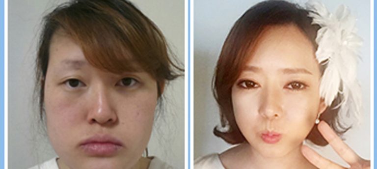 15 Şaşırtıcı Plastik Cerrahi Estetiği!