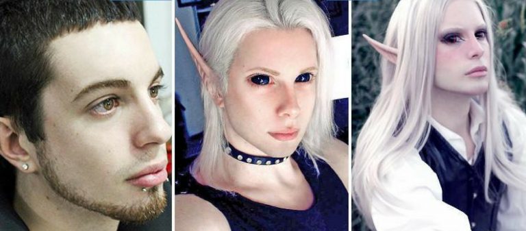 Elf olmak için 30 bin dolar harcadı ve 15 ameliyat oldu