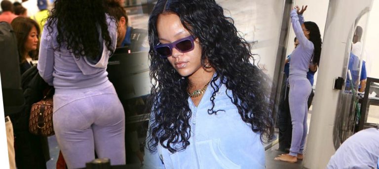 Rihanna X-RAY ‘a Sığamadı