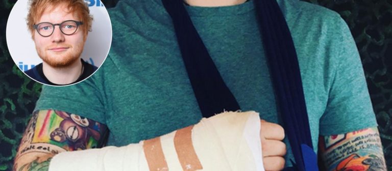 Ed Sheeran, Bisiklet Kazası Geçirdi!