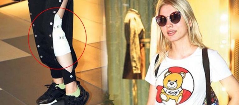 Aleyna Tilki dans ederken sakatlandı