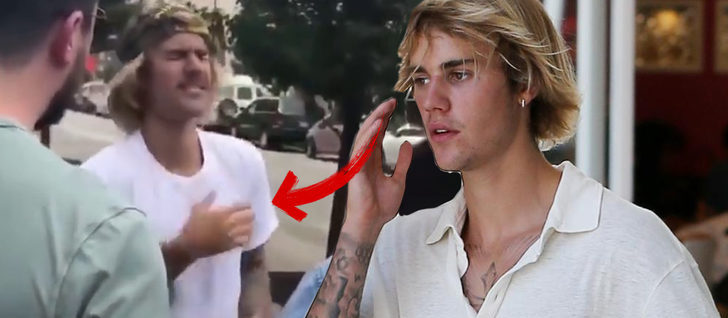 Justin Bieber’ın bu halleri korkuttu!