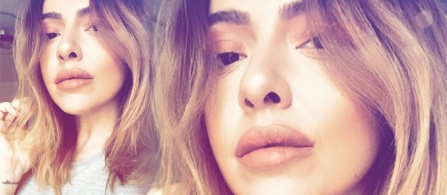 Hadise’nin dudaklarına ne oldu?