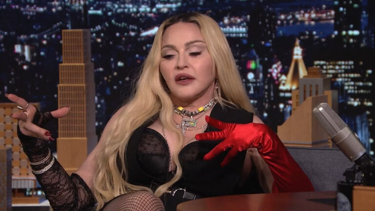 Madonna’dan korkutan paylaşım! Bacağına ne oldu?