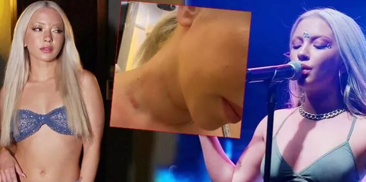 Şarkıcı Ece Seçkin’e sahnede telefon fırlatıldı