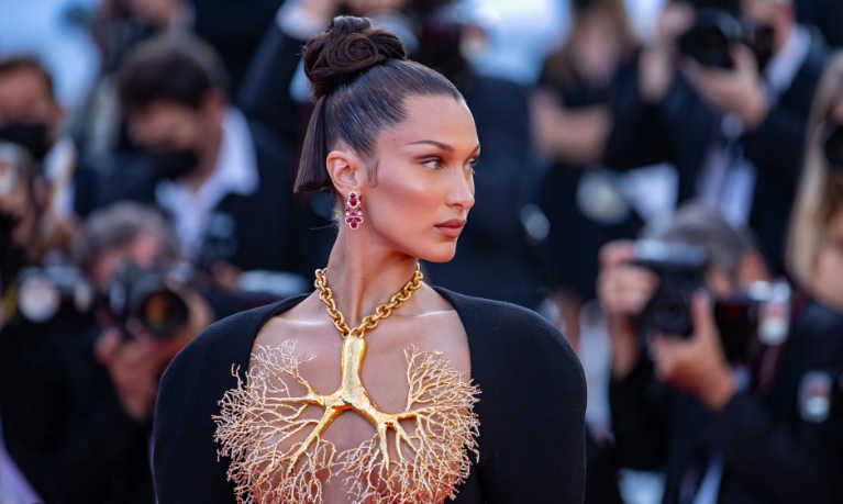 Bella Hadid: Her gün tedavisi olmayan acılar çekiyorum