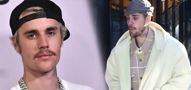 Justin Bieber’ın son hali hayranlarını çok endişelendirdi
