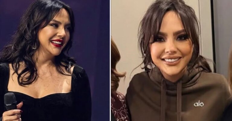 Ebru Gündeş’in estetik sonrası son hali gündem oldu